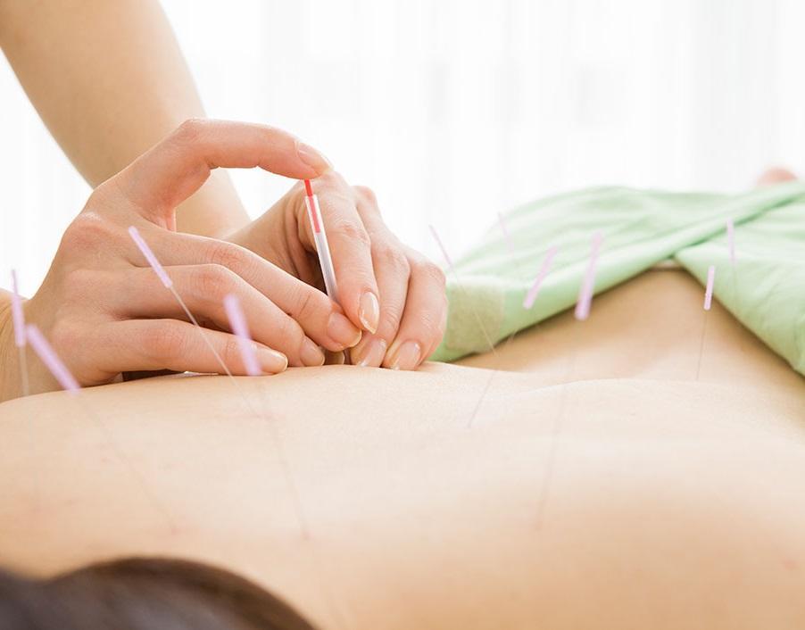 Traditional Acupunture in Bromley UK